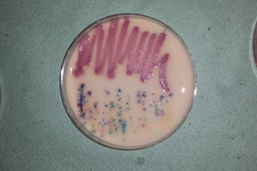 Najczęściej spotykamy się z zakażeniami powodowanymi przez różne gatunki bakterii. Tu E. coli, Enterococcus sp. oraz Staphylococcus sp.
