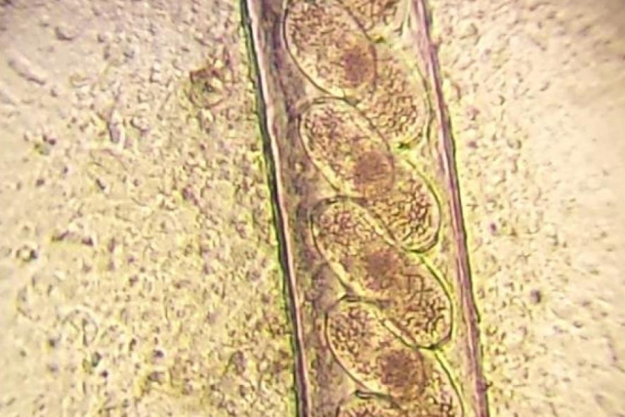 Jaja Capillaria sp. w dorosłym pasożycie